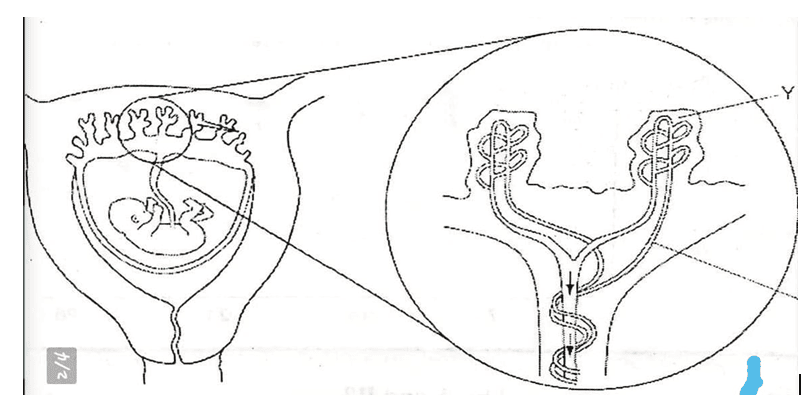 Foetus
